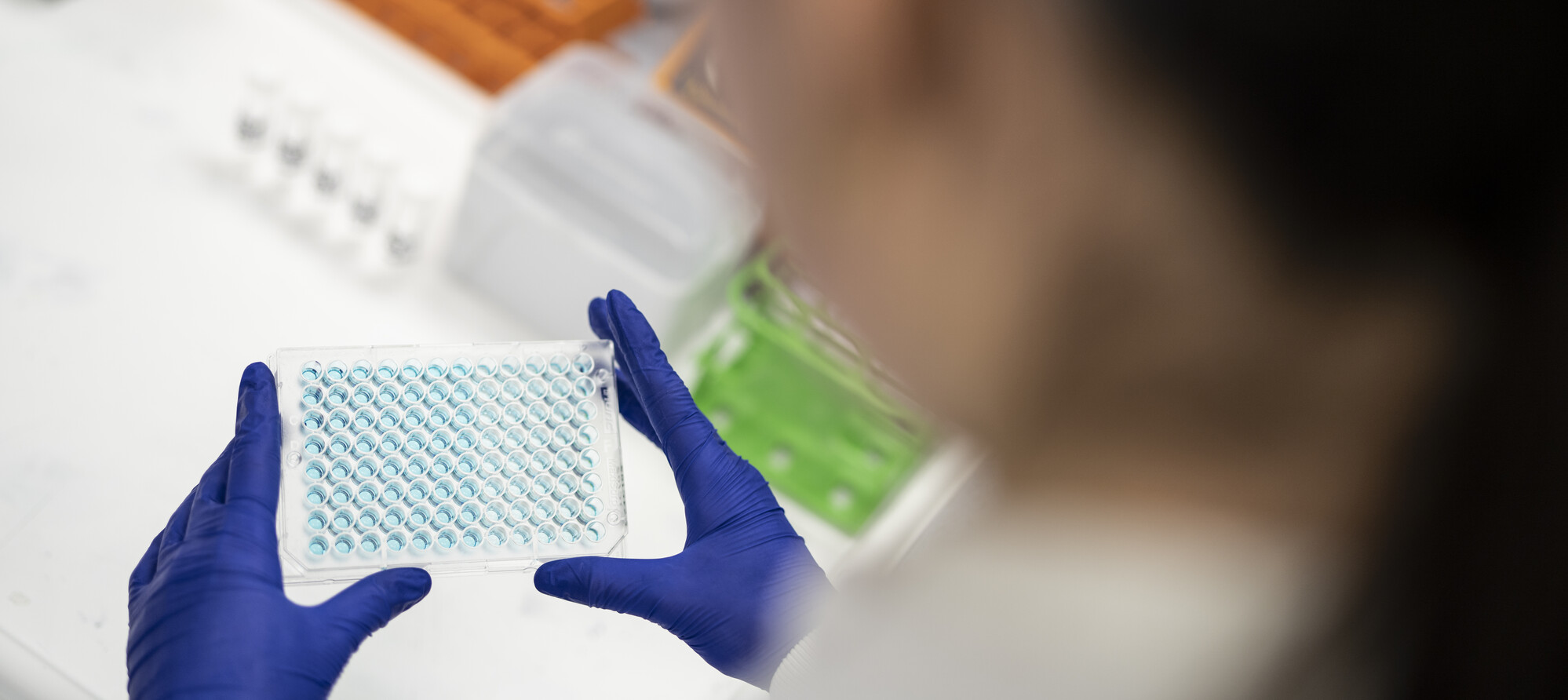 Researcher holding lab samples wearing latex gloves