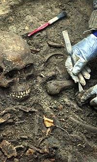 Skull excavation