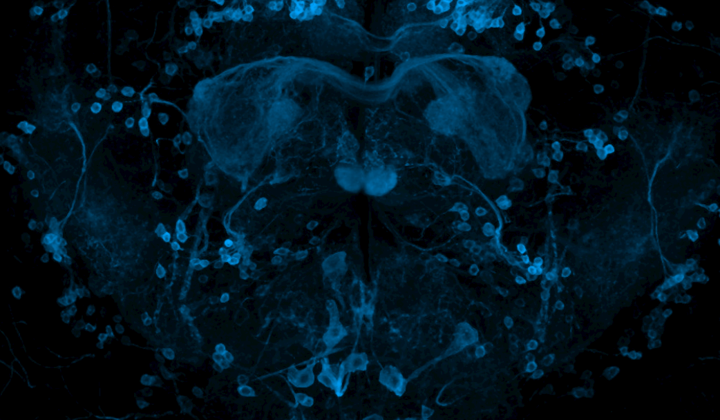 Micrograph of neurons in drosophila